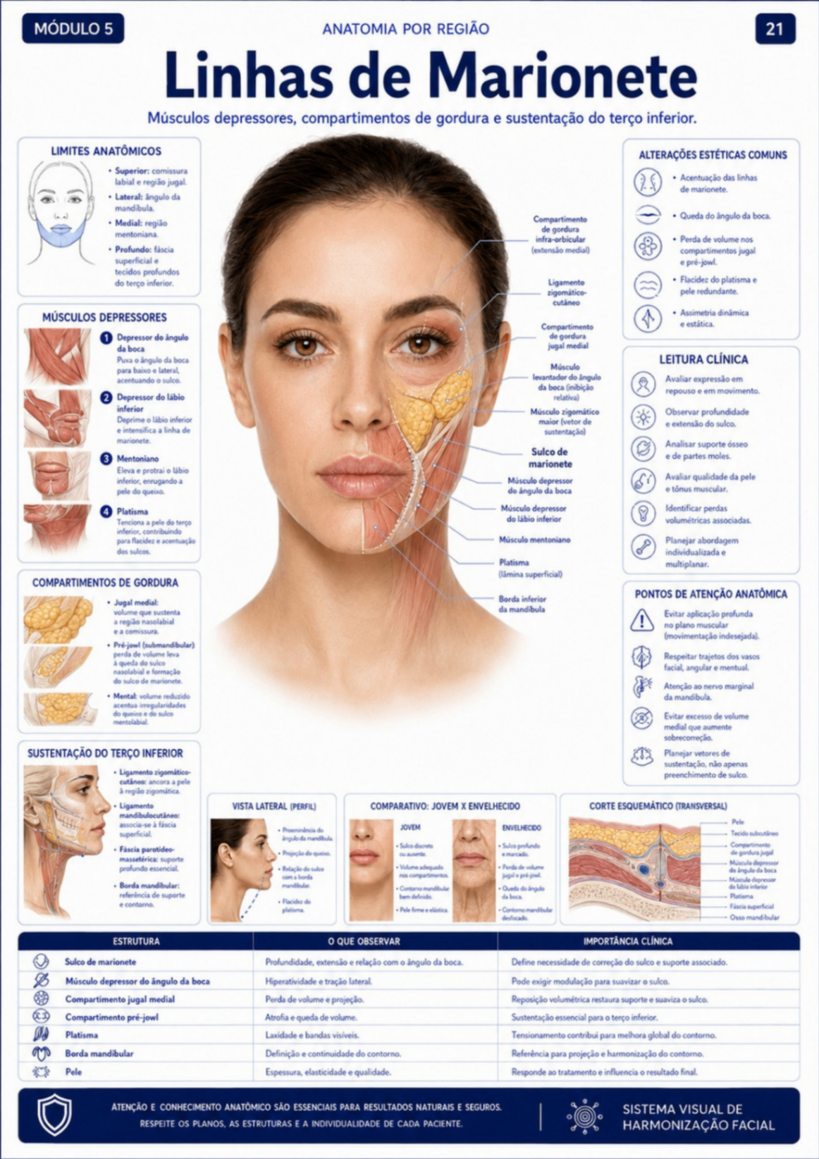 Linhas de Marionete